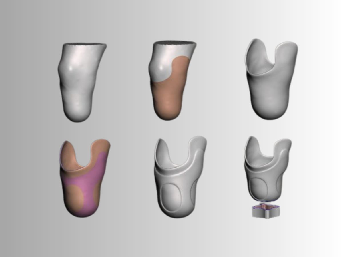 Advanced orthotic AFOs, designed for optimal comfort and stability